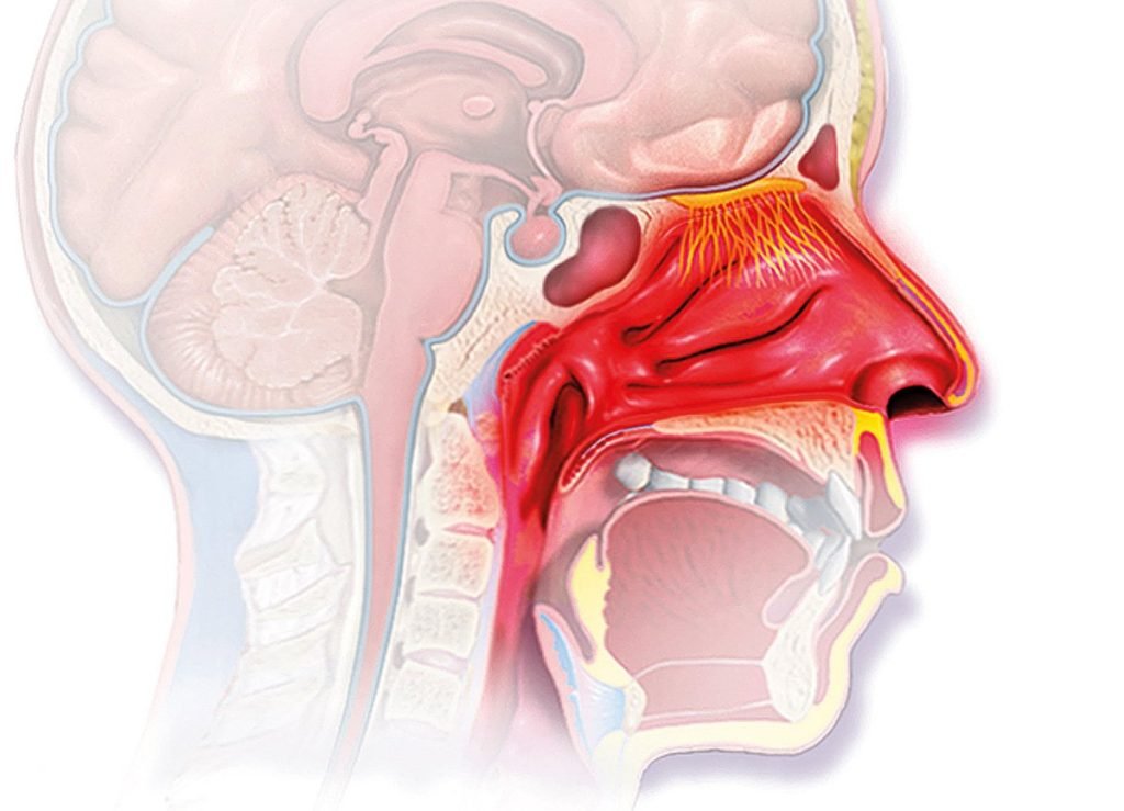 Op. Dr. İbrahim HIRA - Allerjik Rinit